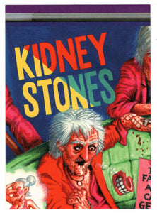 Puzzle # 5: Kidney Stones - (Trading Card) Silly CD's - 2001 Silly Productions Piece # 5B - Mint