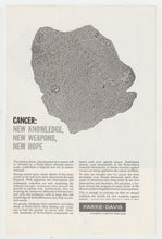 Load image into Gallery viewer, Parke-Davis Medicines - Vintage Ad - (Cancer: New Hope) - # 1071 - 1960's
