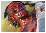 Emulsified Remains (Trading Card) X-Files - Season Three - 1996 Topps # 43 - Mint